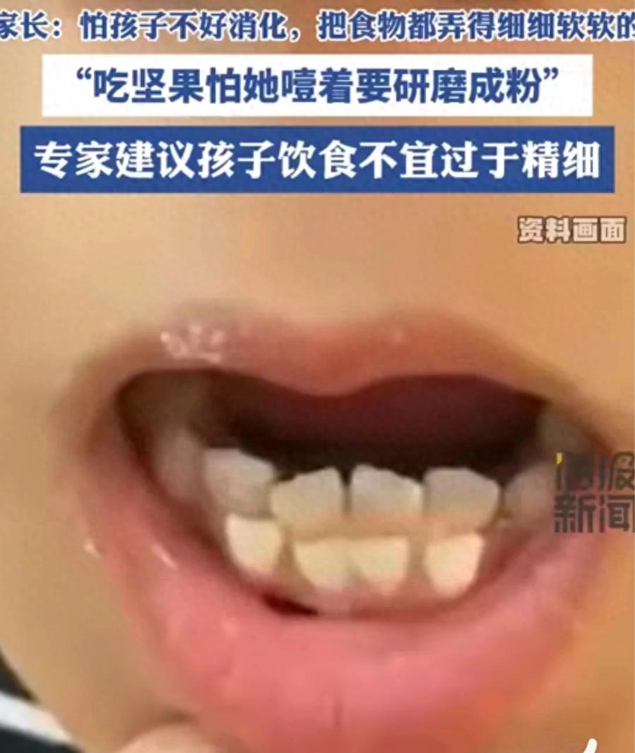 6歲女童吃得太精細(xì)長(zhǎng)出雙排牙